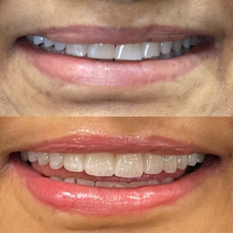 Science Behind Preventive Dental Care in Palm Harbor: Expert Tips and Benefits